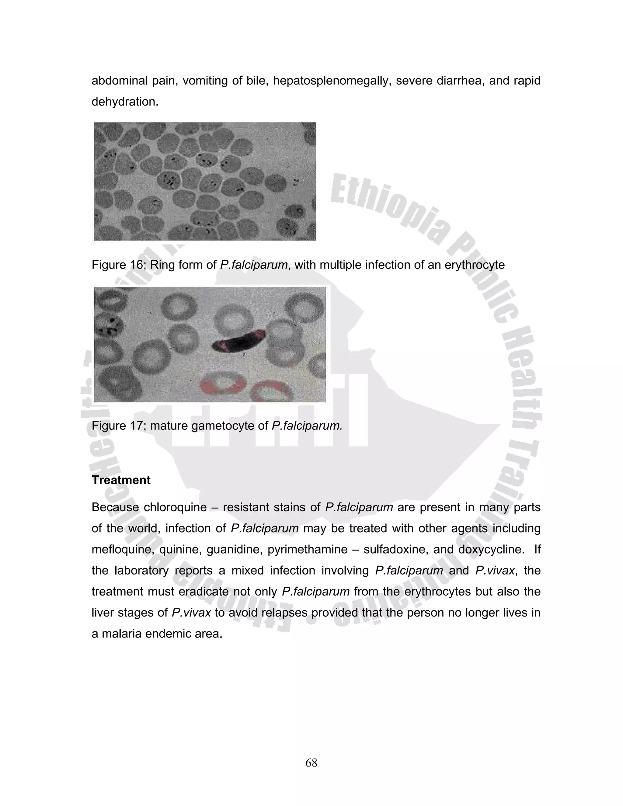 abdominal pain, vomiting of bile, hepatosplenomegally, severe diarrhea, and rapid
dehydration.




Figure 16; Ring form of P.falciparum, with multiple infection of an erythrocyte




Figure 17; mature gametocyte of P.falciparum.



Treatment

Because chloroquine – resistant stains of P.falciparum are present in many parts
of the world, infection of P.falciparum may be treated with other agents including
mefloquine, quinine, guanidine, pyrimethamine – sulfadoxine, and doxycycline. If
the laboratory reports a mixed infection involving P.falciparum and P.vivax, the
treatment must eradicate not only P.falciparum from the erythrocytes but also the
liver stages of P.vivax to avoid relapses provided that the person no longer lives in
a malaria endemic area.




                                        68
 
