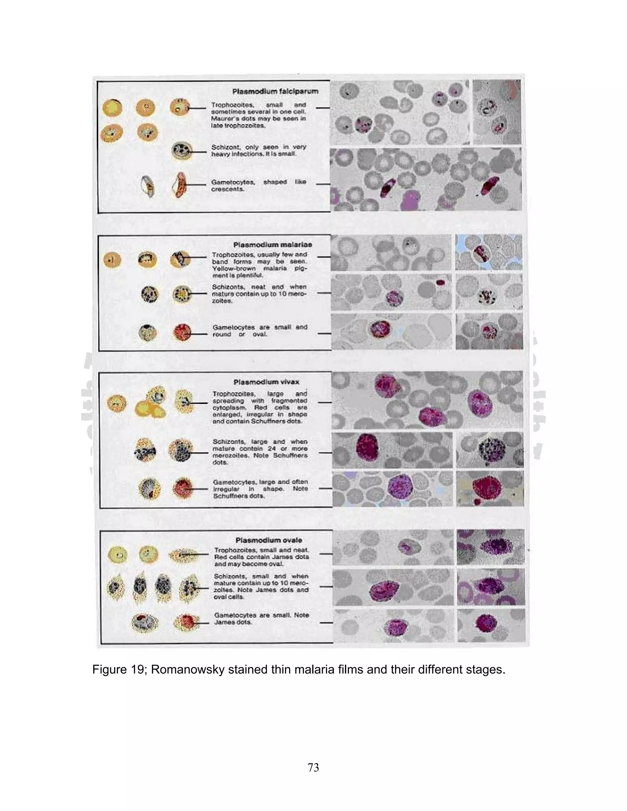 Figure 19; Romanowsky stained thin malaria films and their different stages.




                                       73
 