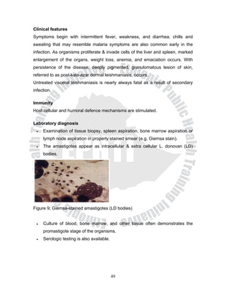 Clinical features
Symptoms begin with intermittent fever, weakness, and diarrhea; chills and
sweating that may resemble malaria symptoms are also common early in the
infection. As organisms proliferate & invade cells of the liver and spleen, marked
enlargement of the organs, weight loss, anemia, and emaciation occurs. With
persistence of the disease, deeply pigmented, granulomatous lesion of skin,
referred to as post-kala-azar dermal leishmaniasis, occurs.
Untreated visceral leishmaniasis is nearly always fatal as a result of secondary
infection.

Immunity
Host cellular and humoral defence mechanisms are stimulated.

Laboratory diagnosis
 •   Examination of tissue biopsy, spleen aspiration, bone marrow aspiration or
     lymph node aspiration in properly stained smear (e.g. Giemsa stain).
 •   The amastigotes appear as intracellular & extra cellular L. donovan (LD)
     bodies.




Figure 9; Giemsa-stained amastigotes (LD bodies)


 •   Culture of blood, bone marrow, and other tissue often demonstrates the
     promastigote stage of the organisms.
 •   Serologic testing is also available.




                                            49
 