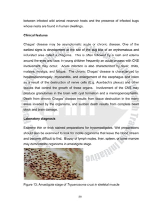 between infected wild animal reservoir hosts and the presence of infected bugs
whose nests are found in human dwellings.

Clinical features

Chagas’ disease may be asymptomatic acute or chronic disease. One of the
earliest signs is development at the site of the bug bite of an erythematous and
indurated area called a chagoma. This is often followed by a rash and edema
around the eyes and face; in young children frequently an acute process with CNS
involvement may occur.    Acute infection is also characterized by fever, chills,
malaise, myalgia, and fatigue. The chronic Chagas’ disease is characterized by
hepatosplenomegaly, myocarditis, and enlargement of the esophagus and colon
as a result of the destruction of nerve cells (E.g. Auerbach’s plexus) and other
tissues that control the growth of these organs. Involvement of the CNS may
produce granulomas in the brain with cyst formation and a meningoencephalitis.
Death from chronic Chagas’ disease results from tissue destruction in the many
areas invaded by the organisms, and sudden death results from complete heart
block and brain damage.

Laboratory diagnosis

Examine thin or thick stained preparations for trypomastigotes. Wet preparations
should also be examined to look for motile organisms that leave the blood stream
and become difficult to find. Biopsy of lymph nodes, liver, spleen, or bone marrow
may demonstrate organisms in amastigote stage.




Figure 13; Amastigote stage of Trypanosoma cruzi in skeletal muscle


                                       59
 
