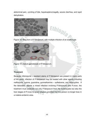 abdominal pain, vomiting of bile, hepatosplenomegally, severe diarrhea, and rapid
dehydration.




Figure 16; Ring form of P.falciparum, with multiple infection of an erythrocyte




Figure 17; mature gametocyte of P.falciparum.



Treatment

Because chloroquine – resistant stains of P.falciparum are present in many parts
of the world, infection of P.falciparum may be treated with other agents including
mefloquine, quinine, guanidine, pyrimethamine – sulfadoxine, and doxycycline. If
the laboratory reports a mixed infection involving P.falciparum and P.vivax, the
treatment must eradicate not only P.falciparum from the erythrocytes but also the
liver stages of P.vivax to avoid relapses provided that the person no longer lives in
a malaria endemic area.




                                        68
 