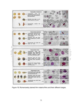 Figure 19; Romanowsky stained thin malaria films and their different stages.




                                       73
 