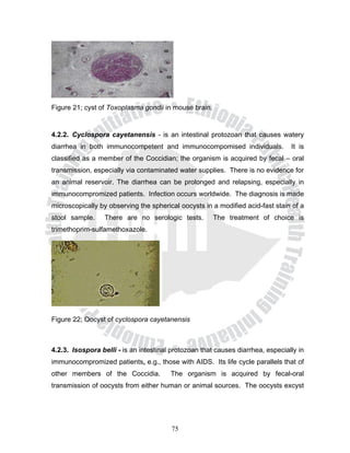 Figure 21; cyst of Toxoplasma gondii in mouse brain.


4.2.2. Cyclospora cayetanensis - is an intestinal protozoan that causes watery
diarrhea in both immunocompetent and immunocompomised individuals.               It is
classified as a member of the Coccidian; the organism is acquired by fecal – oral
transmission, especially via contaminated water supplies. There is no evidence for
an animal reservoir. The diarrhea can be prolonged and relapsing, especially in
immunocompromized patients. Infection occurs worldwide. The diagnosis is made
microscopically by observing the spherical oocysts in a modified acid-fast stain of a
stool sample.     There are no serologic tests.        The treatment of choice is
trimethoprim-sulfamethoxazole.




Figure 22; Oocyst of cyclospora cayetanensis



4.2.3. Isospora belli - is an intestinal protozoan that causes diarrhea, especially in
immunocompromized patients, e.g., those with AIDS. Its life cycle parallels that of
other members of the Coccidia.          The organism is acquired by fecal-oral
transmission of oocysts from either human or animal sources. The oocysts excyst




                                        75
 