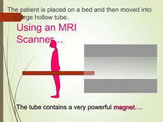 The patient is placed on a bed and then moved into
a large hollow tube.
The tube contains a very powerfulThe tube contains a very powerful magnetmagnet….….
Using an MRI
Scanner…
 