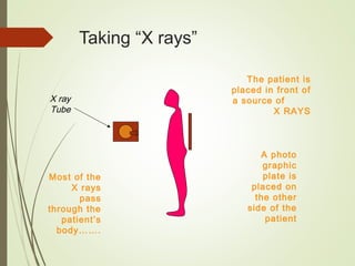 Taking “X rays”
The patient is
placed in front of
a source of
X RAYS
X ray
Tube
A photo
graphic
plate is
placed on
the other
side of the
patient
Most of the
X rays
pass
through the
patient’s
body…….
 