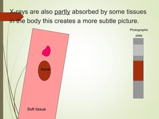 X-rays are also partly absorbed by some tissues
in the body this creates a more subtle picture.
bone
Soft tissue
Photographic
plate
 