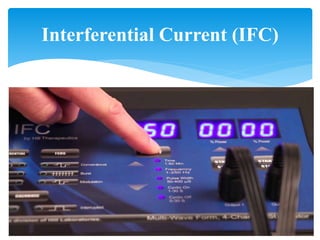 Interferential Current (IFC)
 