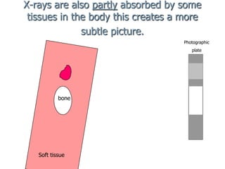 X-rays are also partly absorbed by some
tissues in the body this creates a more
subtle picture.
Photographic
plate

bone

Soft tissue

 
