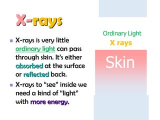 X-rays




X-rays is very little
ordinary light can pass
through skin. It’s either
absorbed at the surface
or reflected back.
X-rays to “see” inside we
need a kind of “light”
with more energy.

Ordinary Light

X rays

Skin

 