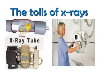 The tolls of x-rays

 