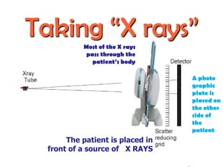 Taking “X rays”
Most of the X rays
pass through the
patient’s body
A photo
graphic
plate is
placed on
the other
side of
the
patient

The patient is placed in
front of a source of X RAYS

 