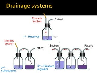Patient
Patient
PatientSuction
Thoracic
suction
Thoracic
suction
1st - Reservoir
2nd -
Subaqueous
3rd – Pressure
regulator
 