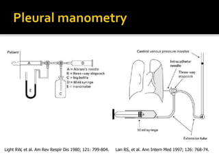 Lan RS, et al. Ann Intern Med 1997; 126: 768-74.Light RW, et al. Am Rev Respir Dis 1980; 121: 799-804.
 