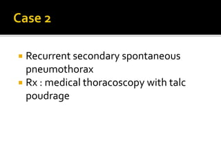  Recurrent secondary spontaneous
pneumothorax
 Rx : medical thoracoscopy with talc
poudrage
 