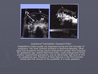 Gestational Trophoblastic Disease(H.Mole) Hydatidiform moles usually are diagnosed during the first trimester of pregnancy. The most common symptom is abnormal bleeding. Other signs and symptoms include uterine enlargement greater than expected for gestational age, absent fetal heart tones, cystic enlargement of the ovaries, hyperemesis gravidarum, and an abnormally high level of hCG for gestational age. Presence of these features in the first trimester should alert the clinician to the possibility of a molar gestation.   