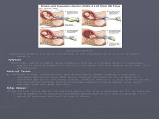 Spontaneous Abortion • Spontaneous abortion, also called a miscarriage, is loss of pregnancy during the first 20 weeks of gestation.  Symptoms • Pelvic pain, passing of vaginal tissue, bleeding or spotting, or a dilated cervix. If a spontaneous abortion is occurring because of an infection in the mother, then other symptoms can be fever, chills and body aches. Maternal Causes • If the mother is older, consumes alcohol, uses caffeine heavily, smokes cigarettes or uses drugs, a spontaneous abortion can occur. Other factors concerning the mother that can contribute to a spontaneous abortion include: chronic diseases, conception immediately following a previous delivery, previous elective abortions, previous miscarriages, exposure to toxins, abdomen trauma, severe emotional change and vitamin deficiency. Fetal Causes • If the umbilical cord is twisted, limiting blood supply to the fetus, a spontaneous abortion can take place. Poor attachment to the uterine wall and genetic abnormalities can also cause a miscarriage. In 25 percent of spontaneous abortions, the cause is unknown. 