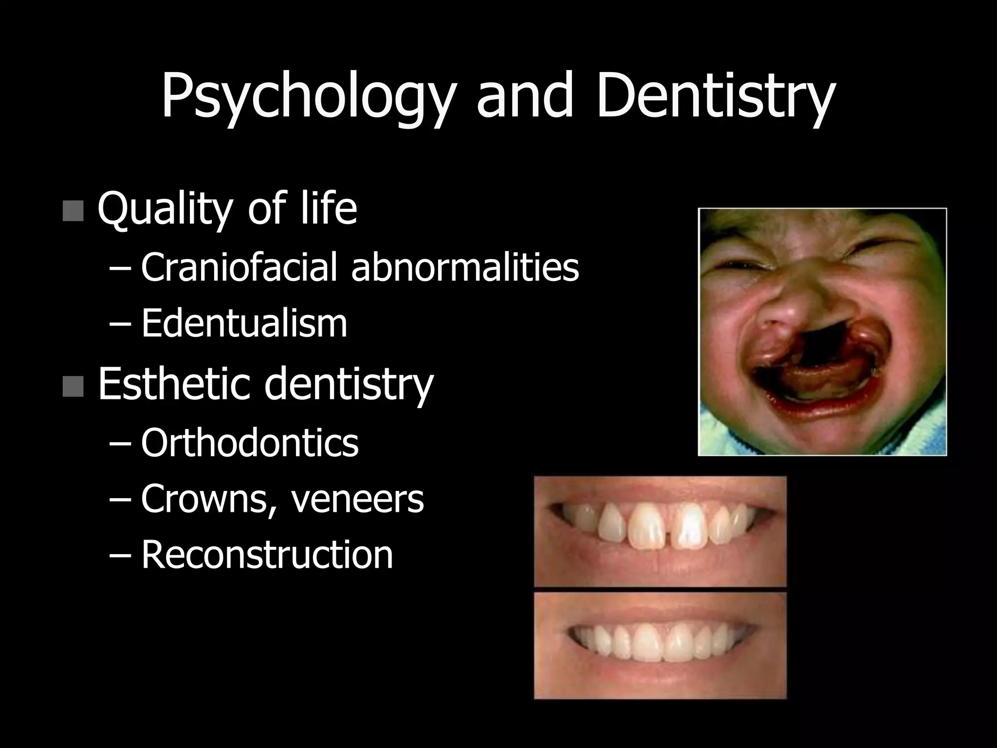 Psychology and Dentistry
 Quality of life
– Craniofacial abnormalities
– Edentualism
 Esthetic dentistry
– Orthodontics
– Crowns, veneers
– Reconstruction
 