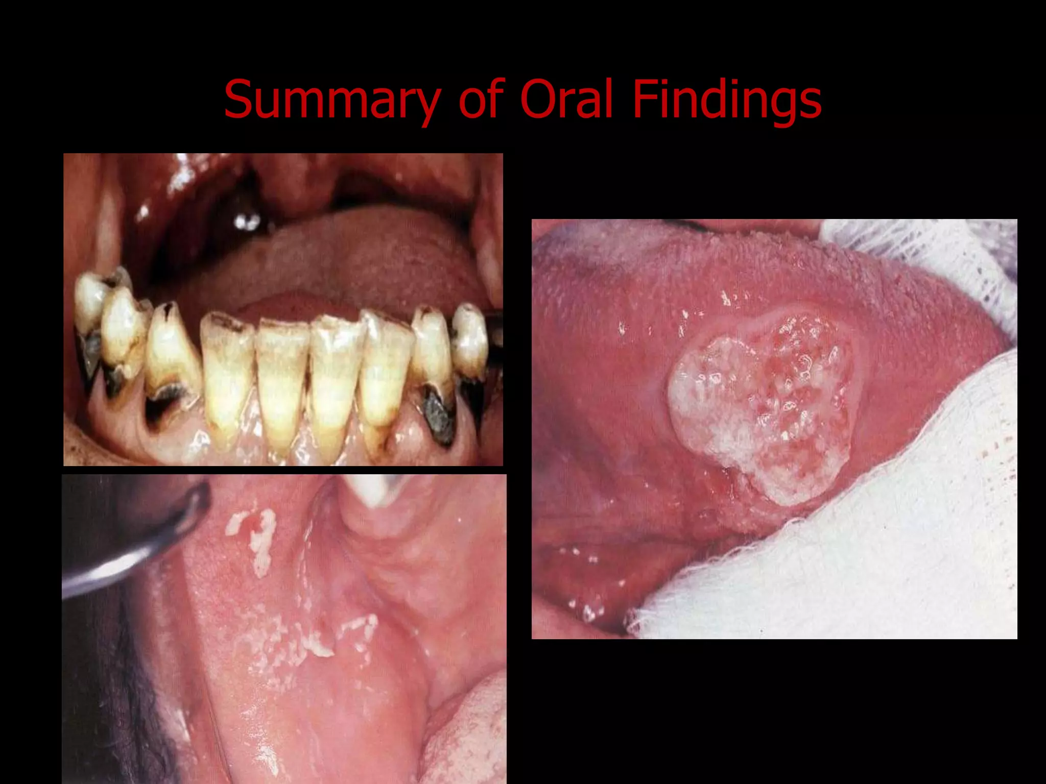 Summary of Oral Findings
 