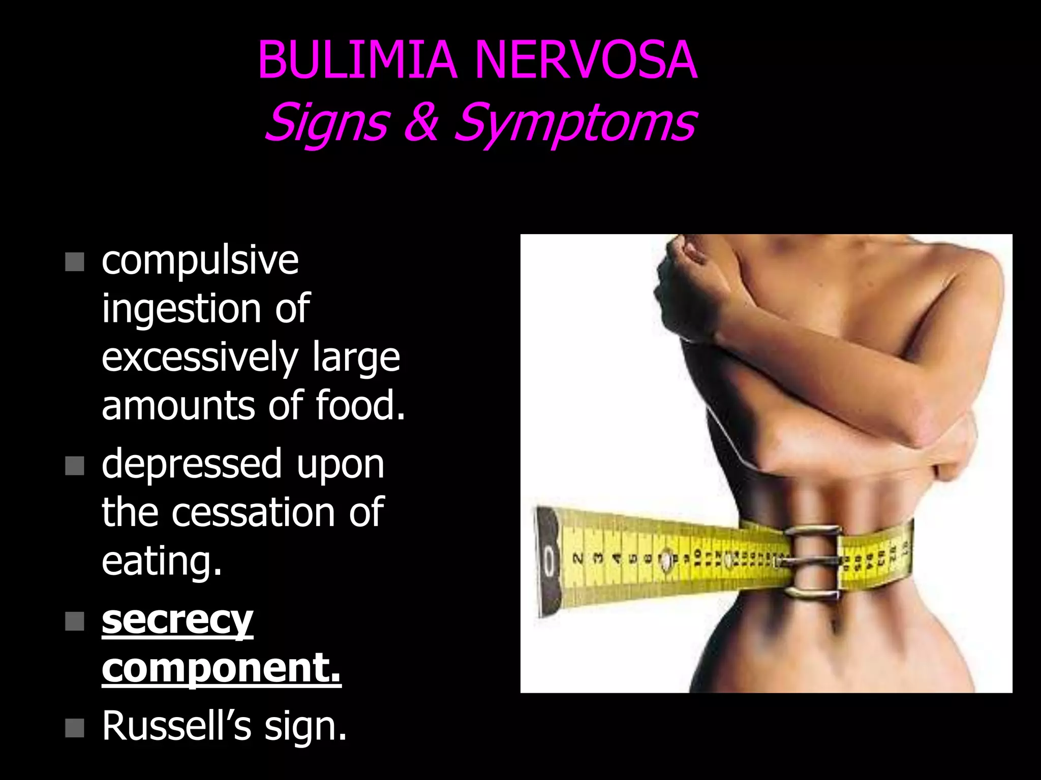 BULIMIA NERVOSA
Signs & Symptoms
 compulsive
ingestion of
excessively large
amounts of food.
 depressed upon
the cessation of
eating.
 secrecy
component.
 Russell‟s sign.
 