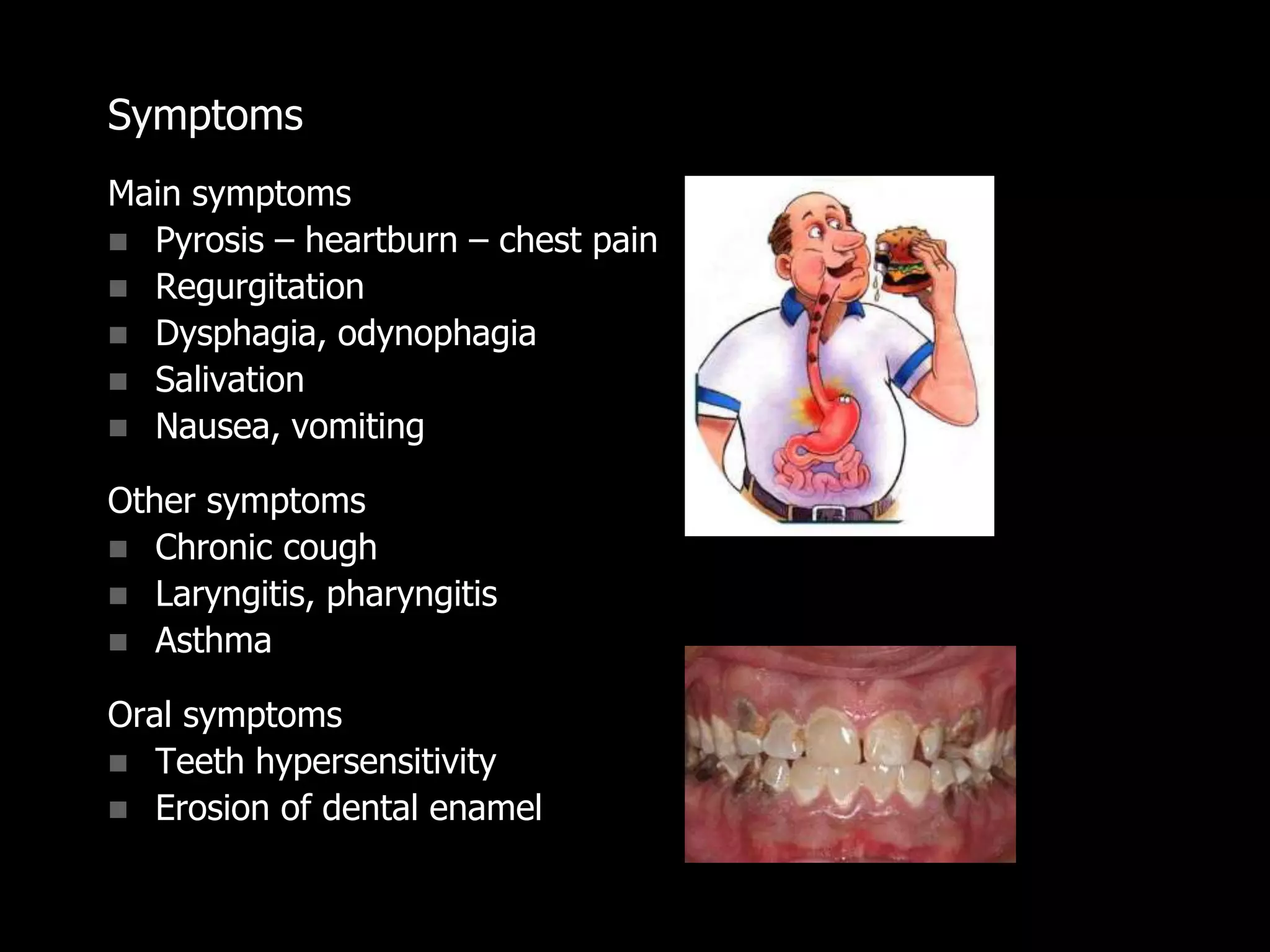 Symptoms
Main symptoms
 Pyrosis – heartburn – chest pain
 Regurgitation
 Dysphagia, odynophagia
 Salivation
 Nausea, vomiting
Other symptoms
 Chronic cough
 Laryngitis, pharyngitis
 Asthma
Oral symptoms
 Teeth hypersensitivity
 Erosion of dental enamel
 