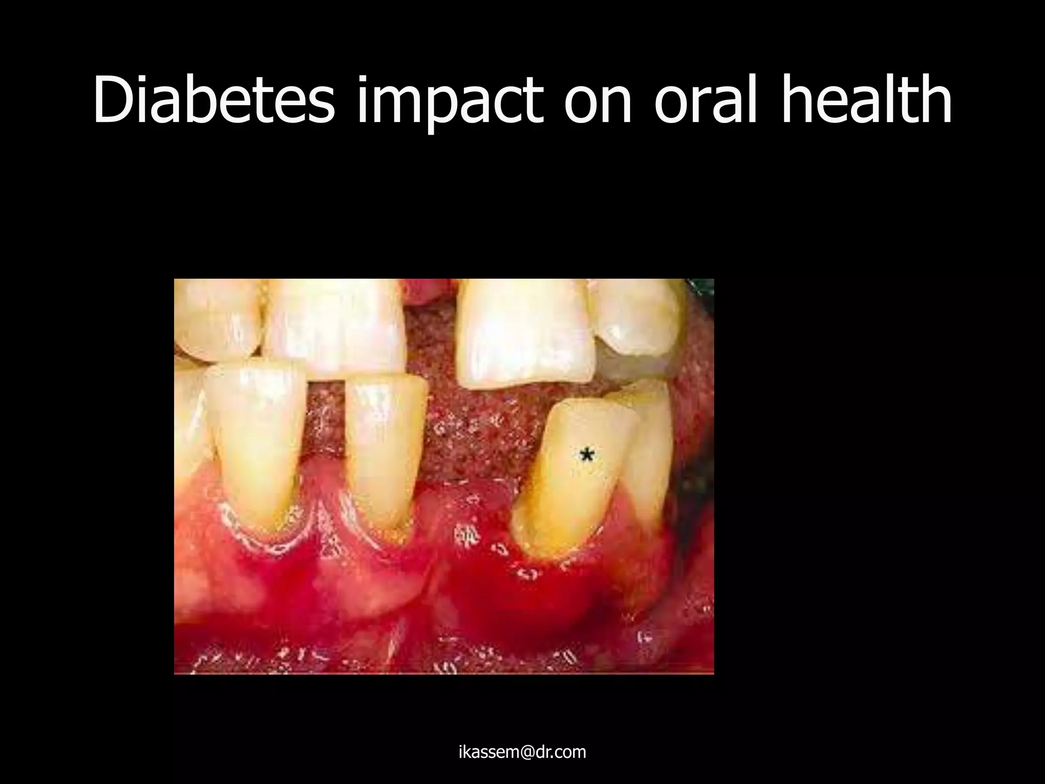 Diabetes impact on oral health
ikassem@dr.com
 