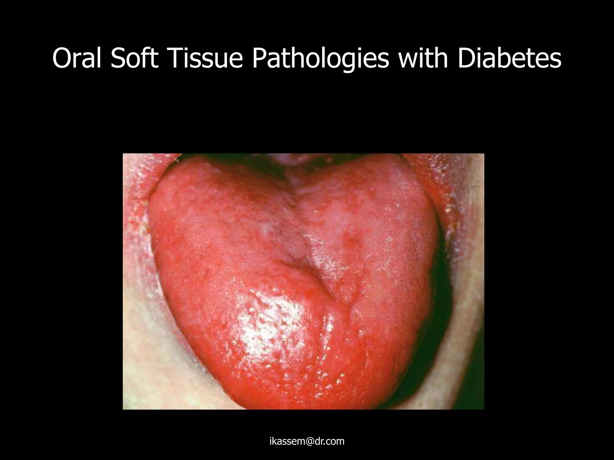 Oral Soft Tissue Pathologies with Diabetes
ikassem@dr.com
 