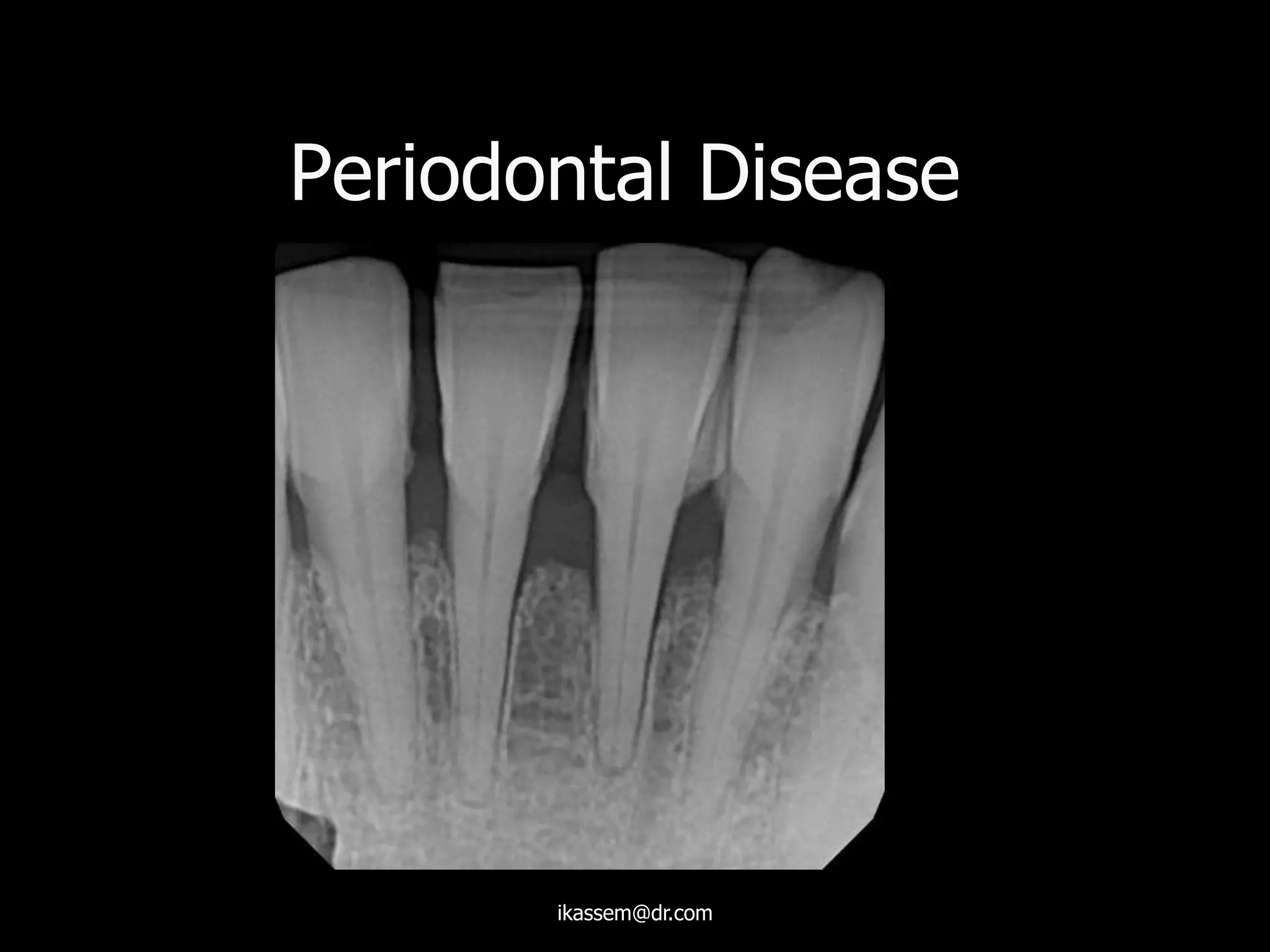Periodontal Disease
ikassem@dr.com
 