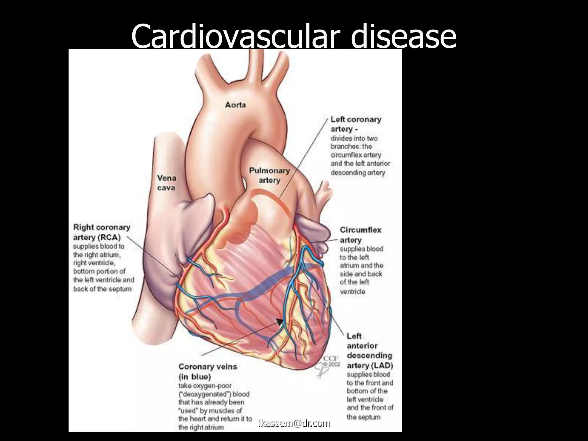 Cardiovascular disease
ikassem@dr.com
 