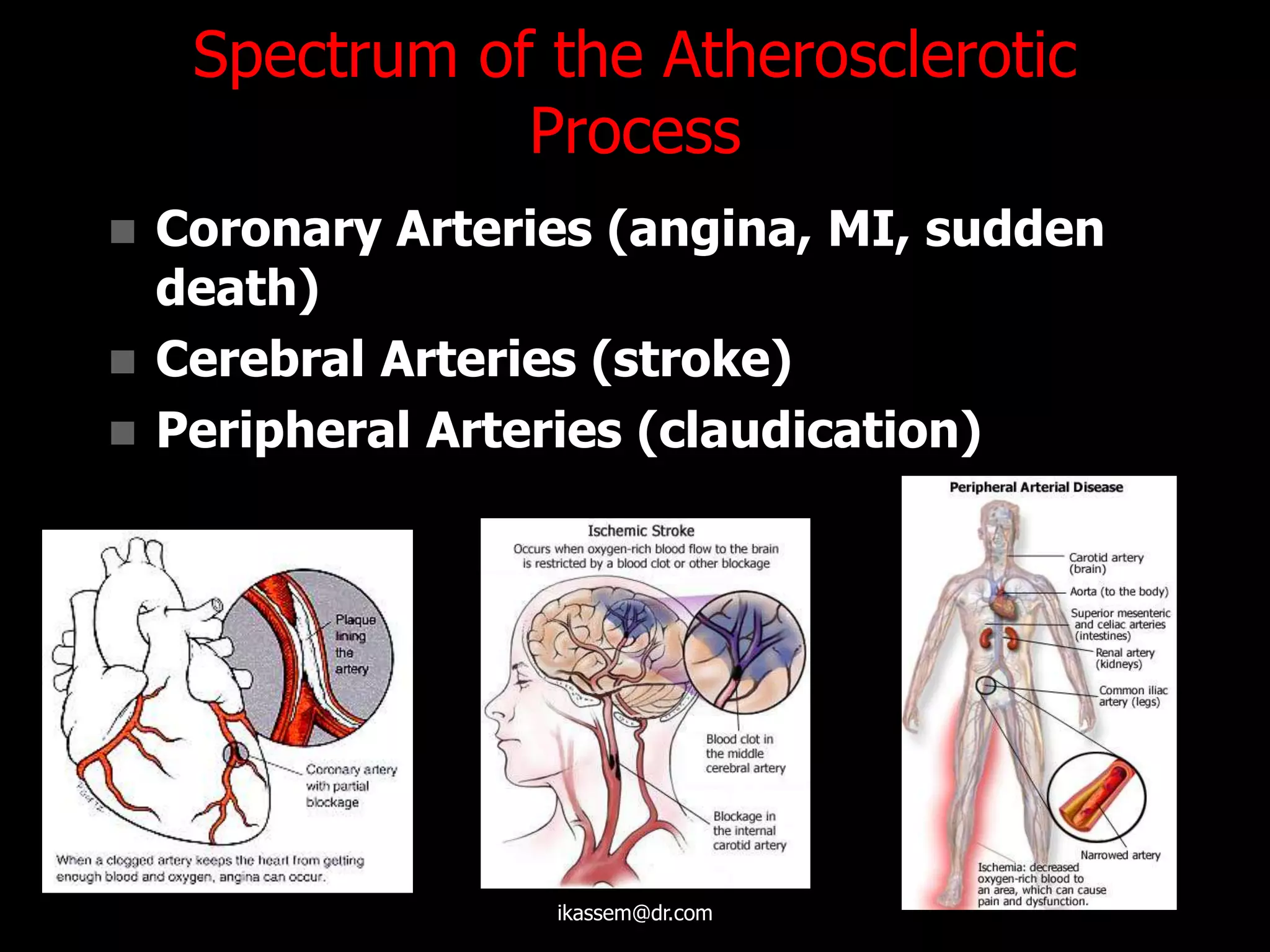 Spectrum of the Atherosclerotic
Process
 Coronary Arteries (angina, MI, sudden
death)
 Cerebral Arteries (stroke)
 Peripheral Arteries (claudication)
ikassem@dr.com
 