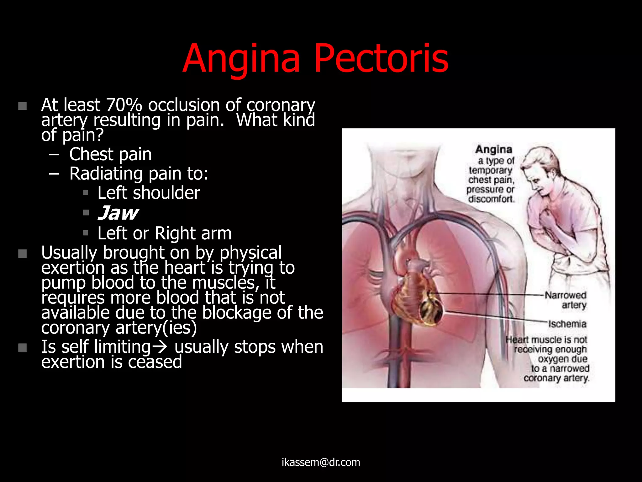 Angina Pectoris
 At least 70% occlusion of coronary
artery resulting in pain. What kind
of pain?
– Chest pain
– Radiating pain to:
 Left shoulder
 Jaw
 Left or Right arm
 Usually brought on by physical
exertion as the heart is trying to
pump blood to the muscles, it
requires more blood that is not
available due to the blockage of the
coronary artery(ies)
 Is self limiting usually stops when
exertion is ceased
ikassem@dr.com
 