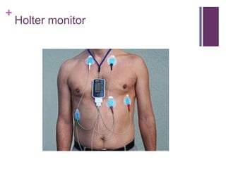 Holter monitor