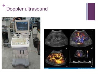 Doppler ultrasound	