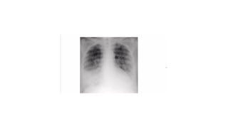 MEDICAL QUESTION FOR MEDICAL STUDENT IN MMED | PPTX