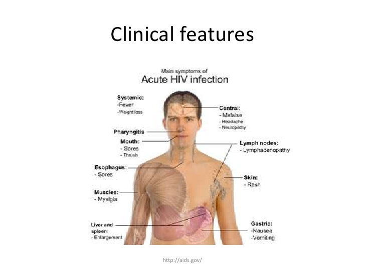 clinical presentation of hiv