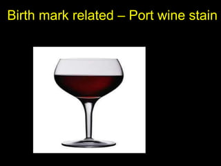 Birth mark related – Port wine stain

 