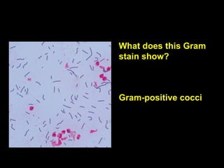 What does this Gram
stain show?

Gram-positive cocci

 