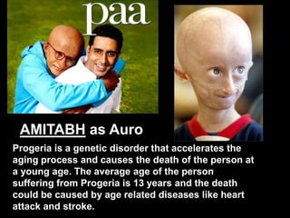 AMITABH as Auro
Progeria is a genetic disorder that accelerates the
aging process and causes the death of the person at
a young age. The average age of the person
suffering from Progeria is 13 years and the death
could be caused by age related diseases like heart
attack and stroke.

24

 