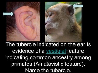 The tubercle indicated on the ear Is
evidence of a vestigial feature
indicating common ancestry among
primates (An atavistic feature).
Name the tubercle.

37

 