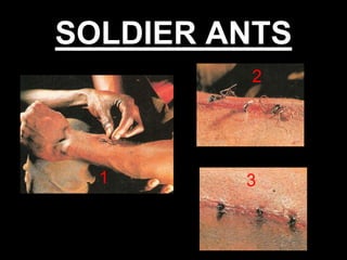 SOLDIER ANTS
2

1

3

53

 