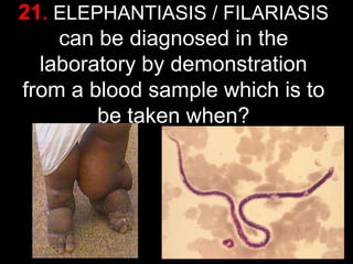 21. ELEPHANTIASIS / FILARIASIS
can be diagnosed in the
laboratory by demonstration
from a blood sample which is to
be taken when?

54

 