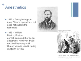First Red Cross ambulance - 1863Anesthetics1842 – Georgia surgeon uses Ether in operations, but does not publish the technique1846 – William Morton, Boston dentist, patents Ether as an anesthetic. However, it was opposed by many until Queen Victoria used it during childbirth in 1853