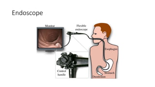 Endoscope