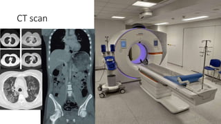 CT scan