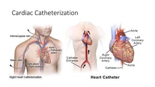 Cardiac Catheterization