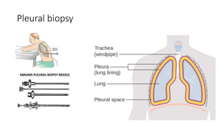 Pleural biopsy
