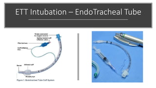 ETT Intubation – EndoTracheal Tube