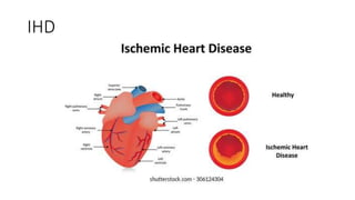 IHD