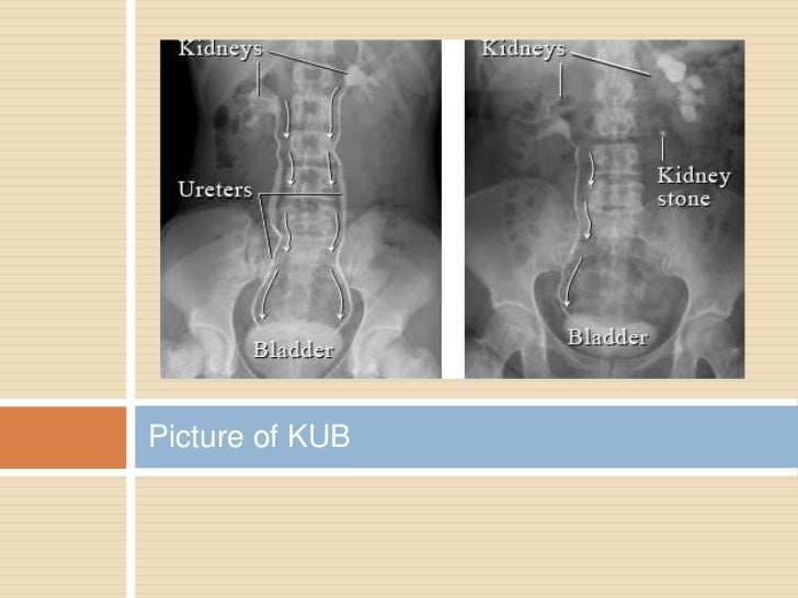 Medical terminology Chpt 9H Urinary System Abbrv