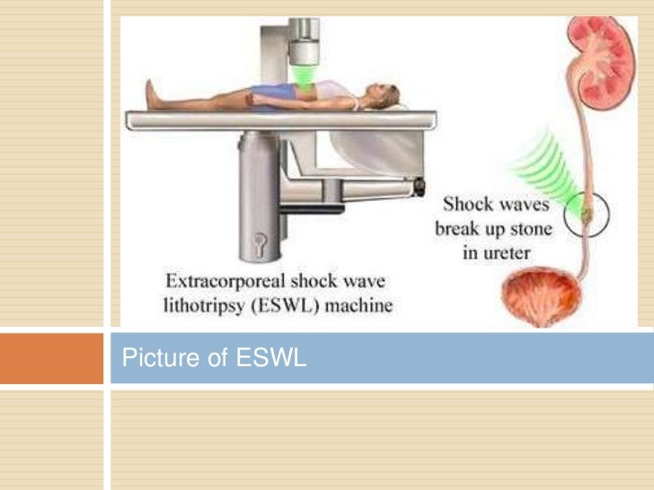 Medical terminology Chpt 9H Urinary System Abbrv