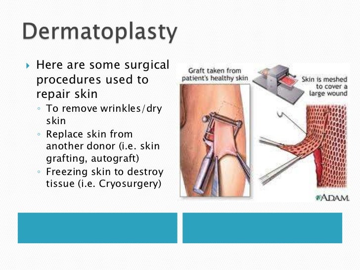 Medical terminology Chapter 3B Skin